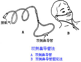 ◆肺病患者如何家庭氧疗？